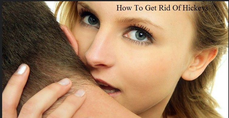 HOW TO GET RID OF HICKEYS