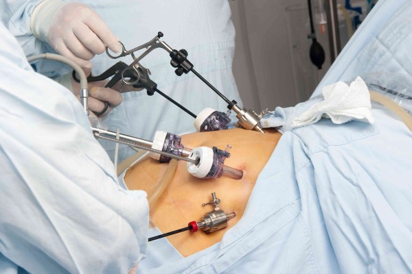 Everything You Need To Know About Bariatric Surgery