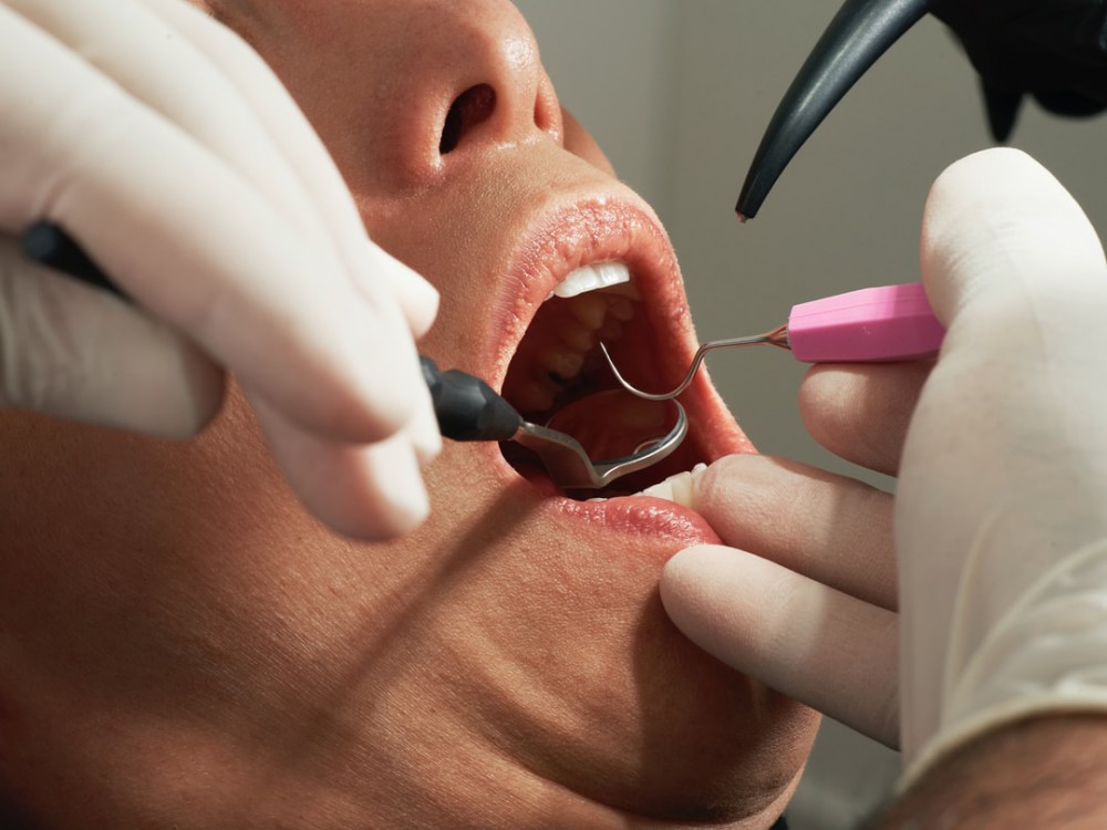 What Is the Science Behind Tooth Sensitivity?